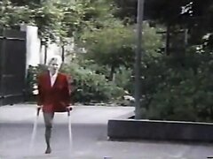 HD Amputee On Bridge 1